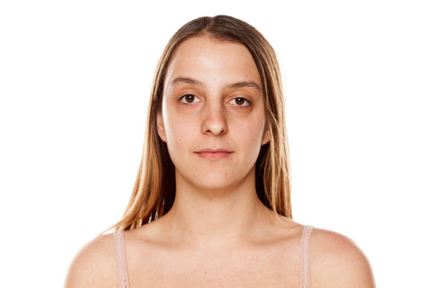 young-woman-without-makeup-on-white-background.jpg