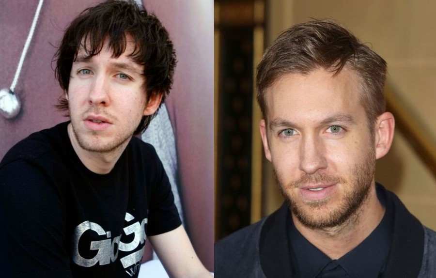 Calvin-Harris-before-and-after-plastic-surgery-20.jpg